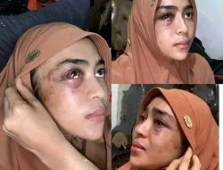 Keluh Kesah Wanita Berumah Tangga Dengan Muka Bonyok
